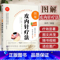 图解针刀疗法 [正版]无视频-图解皮内针疗法 中医适宜技术操作入门丛书 针灸治疗学 针
