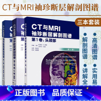 [正版]CT与MRI袖珍断层解剖图谱3卷头颈部胸心腹盆腔脊柱四肢关节高清CTMRI图像CTMRI断层解刨影像彩色插图学