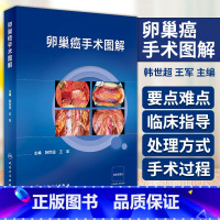 [正版]卵巢癌手术图解 人民卫生出版社 韩世超等 肿瘤细胞减灭术 腹主区域融合转移淋巴结切除术 卵巢癌手术相关解剖 阑