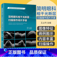 [正版]简明眼科相干光断层扫描操作阅片手册 王占平 北京科学技术出版社 朝聚眼科医院集团眼科检查系列丛书 眼科手册眼科