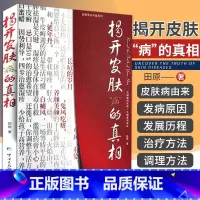 [正版] 揭开皮肤病的真相 田原 著 中国医药科技出版社 97875067