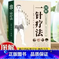 [单册]图解一针疗法 [正版]图解一针疗法 针虽细物道通神 上合于天下合人 中医学教程书籍 针灸疗法穴位中医临床腧穴定位