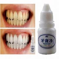 [一用变白]牙斑净10ml速效去除黄牙烟牙牙垢黑渍洗牙粉美白牙齿 牙斑净美白牙齿