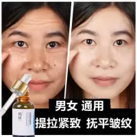 皱纹克星/抗皱祛皱纹/祛抬头纹鱼尾纹法令纹紧致护肤面部精华液