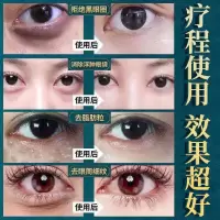 抗衰老眼霜去皱纹去眼袋去黑眼圈袪鱼尾纹去细纹紧致抗皱去脂肪粒 *[拍壹瓶发贰瓶]/40ml