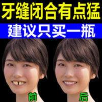 [牙缝宽大]牙膏修复牙龈萎缩牙齿松动牙龈敏感出血牙痛牙黄 120g