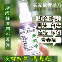 去黑头鼻贴神器收缩毛孔吸黑头粉刺去角质面膜学生鼻子螨虫祛痘痘 去螨净100ml祛痘粉刺加强版