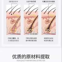 南京同仁堂生发液秃顶头发快速生长发际线增发密发防脱育发剂学生 百年南京同仁堂防脱育发 1瓶[针对各种脱发]