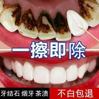牙齿美白去黄牙神器速效去烟牙黑渍牙垢牙斑净洗牙粉液牙膏牙结石