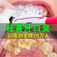 []洁牙慕斯牙膏美白牙齿去黄牙结石烟渍洗牙粉脱色剂 [随机发]限抢