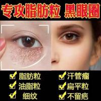 [专攻脂肪粒]南京同仁堂去汗管粒油脂粒祛除扁平粒眼霜神器