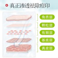 片仔癀皇后净痘调理益肤霜清爽型男女祛痘霜去粉刺痘印祛痘膏学生