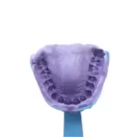 [取模工具]隐形矫正牙套牙齿矫正透明牙套保持器龅牙地包天牙缝 取模工具[送矫正方案]