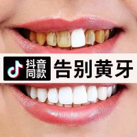 [去牙结石 一喷就掉]洁牙慕斯牙齿美白脱色剂去黄牙烟牙洗牙粉 [牙医推荐]牙齿白起来 1瓶体验装