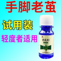 快速去老茧 无痛掉茧]去手脚老茧厚茧关节茧脚底厚皮脚垫用特效 1盒装 收藏店铺优先发货