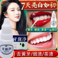 去牙渍神器烟渍去黄美白牙齿牙斑净黄黑牙学生速效去除茶渍洗白牙 试用装一盒1瓶[体验期] 加急火速当天发货