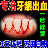 刷牙出血护龈特效牙膏]牙龈出血牙龈肿痛牙龈炎牙周炎]改善牙龈 1支