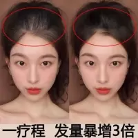 生发液增发密发秃顶发际线防脱育发液生发剂学生变长快速生长液 1瓶(体验装)
