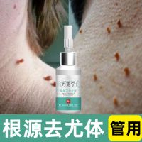 [无痛去疣]去除脖子小肉粒赘皮扁平尤祛疣瘊丝状尤腋下小猴子 轻度一周期1瓶