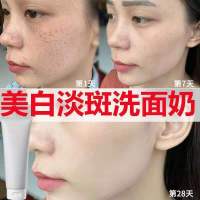 美白祛斑洗面奶女男补水保湿淡斑去黄去黑头收缩毛孔深层清洁面乳 2021升级版1瓶美白祛斑洗面奶