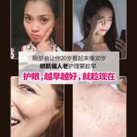 眼霜去眼袋抗衰老去细纹紧致抗皱去黑眼圈去脂肪粒去皱纹眼部护理 1瓶*/[男女通用]体验装