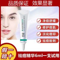 水杨酸祛痘欧诗漫祛痘精华液去除青春痘淡化痘印痘疤粉刺男女学生 一支6g(过敏测试 祛痘效果不明显