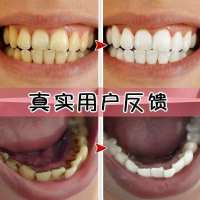 [牙齿美白神器 不白退全款]云南本草牙齿脱色剂美白去黄洗牙粉 一瓶装50g+不送止痛贴 美白 祛烟 茶渍 牙石 牙斑 槟