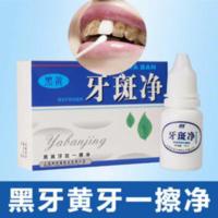 牙齿美白速效去除黄牙烟渍牙垢氟斑牙洗牙液洗牙粉小苏打牙贴神器 牙齿美白速效去除黄牙烟渍牙垢氟斑牙洗牙液洗牙粉小苏打牙贴神