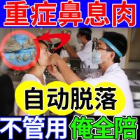 鼻炎喷剂[1喷见効]鼻息肉急慢性鼻窦炎鼻塞鼻甲肥大流涕不通气 一盒缓解装[快速脱落]