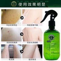 去痘印痕背部祛痘背上祛痘印去背部痘痘胸前后背祛痘印喷雾美背液 [大容量300ml]美背喷雾