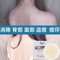 美白海盐皂除螨皂洗面奶学生黑头手工皂祛痘控油羊奶洗脸香皂 一盒海盐皂[改善肌肤]
