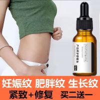 去妊娠纹产后修复霜紧致预防妊娠纹淡化肥胖纹去疤膏孕妇专用