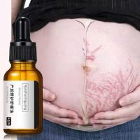 去妊娠纹产后修复精油孕妇预防消除妊娠纹专用紧致提拉肚皮孕妇 [1瓶]妊娠纹精油