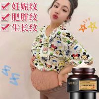 花田美芙妈咪修护精华霜 孕妇祛去除淡化妊娠产后肥胖纹预防妊辰