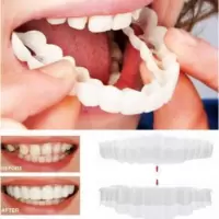 牙套吃饭神器假牙套仿真通用缺牙临时牙套遮盖门牙缺牙临时牙填充 上牙套