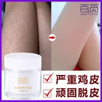 50g 去鸡皮鱼鳞神器腿上鸡皮肤救星去除鸡皮疙瘩毛囊角质身体乳学生全
