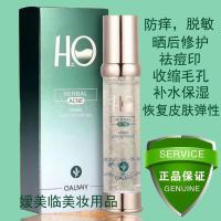 卡尔曼尼本草多效修护啫喱露 痘拜拜祛痘控油青春痘粉刺痘印