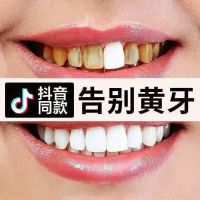 洁牙慕斯[一瓶] [我很大瓶150ml 不白退全款]洁牙慕斯牙齿美白脱色剂去黄洗牙粉