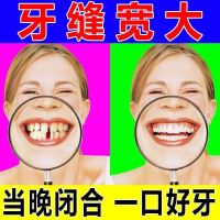 牙缝宽大[严丝合缝]修复牙龈萎缩牙齿松动敏感上火固齿护龈牙膏