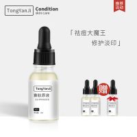 [买2送1]寡肽原液快速祛痘青春痘淡化痘印痘疤痘坑去痘霜精华液