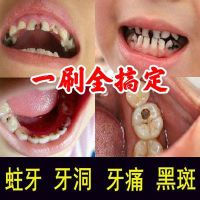 [修补龋齿牙洞]牙缝快速补牙修复黑斑牙虫牙齿蛀牙填充防蛀牙膏 [七天修补牙洞蛀牙虫牙] [普通款]没功效