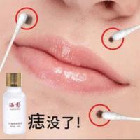 祛痣神器无痕去黑点美白祛斑淡斑祛痘印淡化脸部瑕疵玫瑰净颜精油 祛痣神器无痕去黑点美白祛斑淡斑祛痘印淡化脸部瑕疵玫瑰净颜精