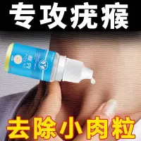 去瘊子刺瘊猴子贴治鸡眼跖疣瘊子膏跖疣趾疣特效去除瘊子跖疣鸡眼 1盒装30ml[体验效果]