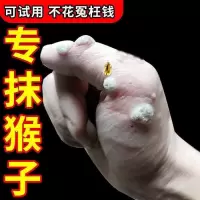 去除脖子小肉粒颈部手足赘皮温和不留疤祛丝状尤腋下小猴子鸡眼膏