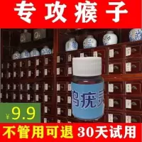 治瘊子鸡眼跖疣寻常疣去刺猴子肉刺鸡眼膏病毒疣趾疣鸡疣灵