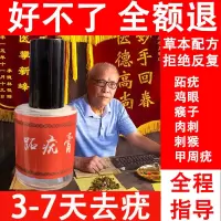 去除跖疣鸡眼膏祛手足部瘊子肉刺刺猴甲周疣寻常疣老茧脚垫跖疣膏