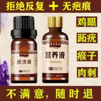 去除手足部瘊子鸡眼膏治肉刺甲周疣特效跖疣膏趾疣寻常疣刺猴子 20g膏+30ml液 防再生 不留疤