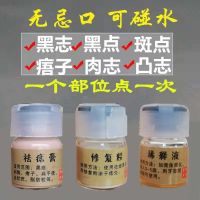 点痣膏祛痣神器无痕祛痣膏祛斑点痦子瘊子黑痣脸部除痣去痣 祛痣膏+修复粉+稀释液+工具