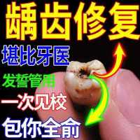 快速修复蛀牙修补牙洞黑斑大人儿童虫牙菌斑牙龈肿痛牙痛防蛀牙膏 5倍功效[血亏] 修复牙洞填充 承诺无校全退