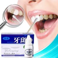 牙斑净洗牙液洗牙洁牙粉非牙齿美白神器速傚去黄牙烟牙垢渍牙结石